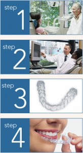 the 4-steps of Invisalign