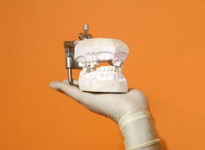 Common Orthodontic Problems