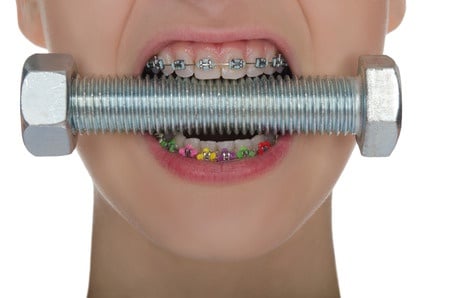 Braces and a bolt