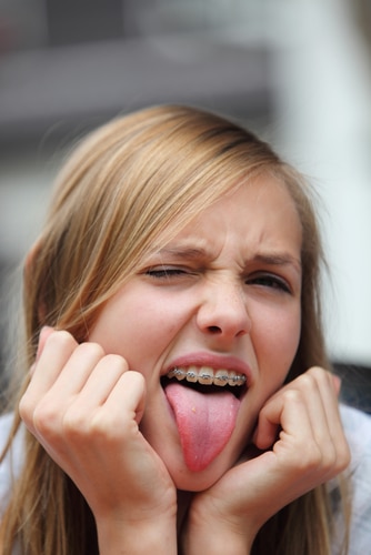 Young girl with braces sticking her tongue out
