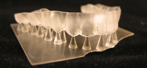 Plastic mold of upper teeth created in 3D printer