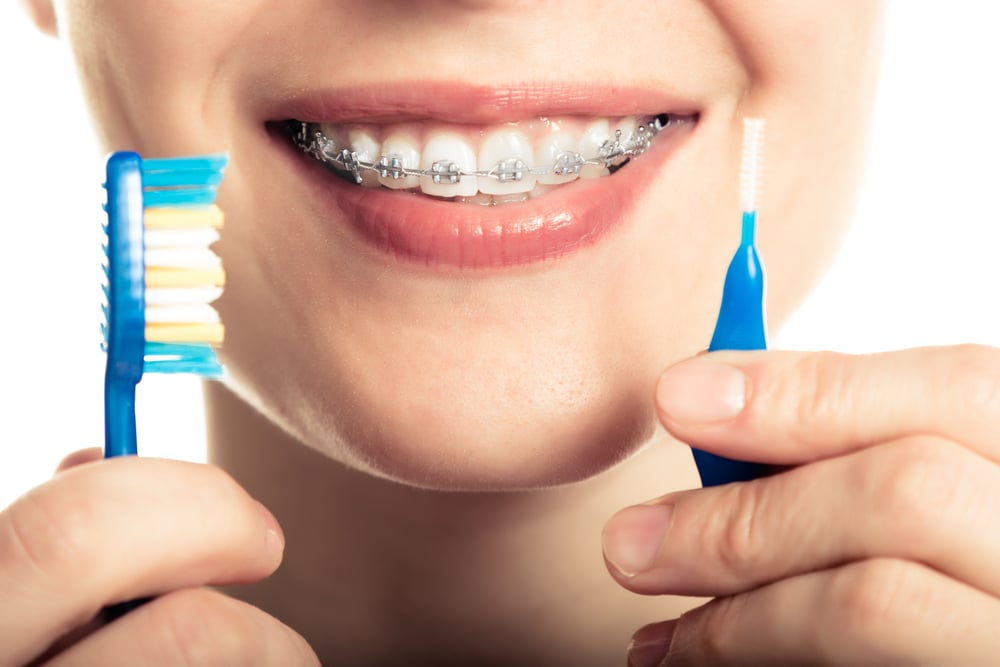 Smiling face with braces and cleaning appliances