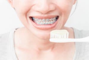 braces an toothbrush with toothpaste