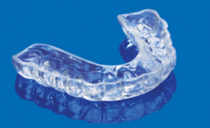 example of a dental night guard