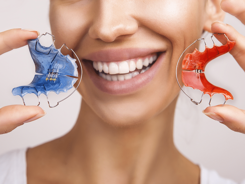Smiling woman holding removable retainers