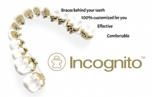 Incognito™  Orthodontic Associates